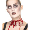 Stacheldraht-Verletzung - Thumbnail Image 1