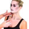 Stacheldraht-Verletzung - Thumbnail Image 2
