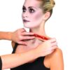 Stacheldraht-Verletzung - Thumbnail Image 3