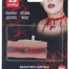 Stacheldraht-Verletzung - Thumbnail Image 7