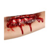 Offene Wunde - Thumbnail Image 1